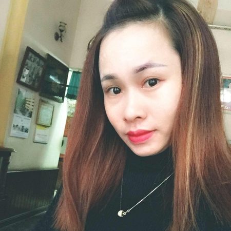Kết quả khắc phục mắt bị da chùng của chị Tuyết