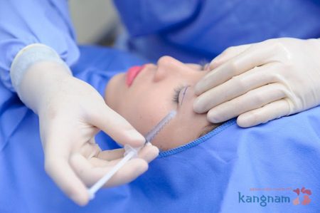 Bác sĩ tiến hành cắt mí mắt Hàn Quốc1