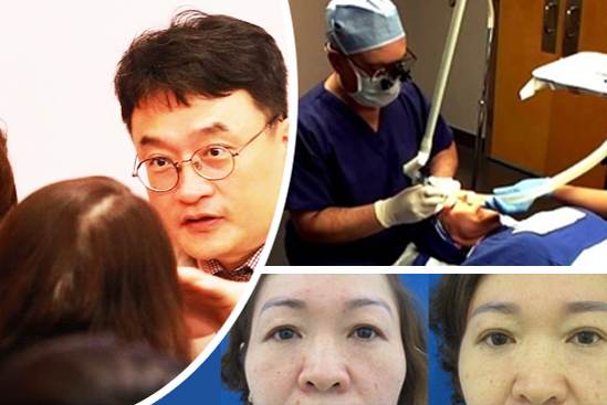 Cắt mí mắt Eyelid là gì?11