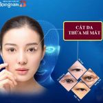 Cắt da thừa mí mắt trên (dưới) được thực hiện như thế nào?