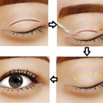 Thẩm mỹ cắt mí mắt Hàn Quốc dưới góc nhìn chuyên gia